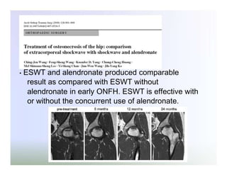 •

ESWT and alendronate produced comparable
result as compared with ESWT without
alendronate in early ONFH. ESWT is effective with
or without the concurrent use of alendronate.

 