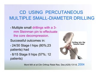 CD USING PERCUTANEOUS
MULTIPLE SMALL-DIAMETER DRILLING
•

Multiple small drillings with a 3mm Steinman pin to effectuate
the core decompression.

Successful outcomes in:
24/30 Stage I hips (80%;23
patients) had
•

8/15 Stage II hips (57%; 12
patients)
•

Mont MA et al Clin Orthop Relat Res. Dec;(429):131-8, 2004

 