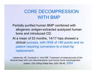 CORE DECOMPRESSION
WITH BMP
Partially purified human BMP combined with
allogeneic antigen-extracted autolyzed human
bone and introduced CD.
At a mean of 53 months, 14/17 hips showed a
clinical success, with HHS of >80 points and no
patient requiring conversion to a total hip
replacement.
Lieberman JR, Conduah A, Urist MR. Treatment of osteonecrosis of the
femoral head with core decompression and human bone morphogenetic
protein. Clin Orthop Relat Res.;429:139-45. 2004

 