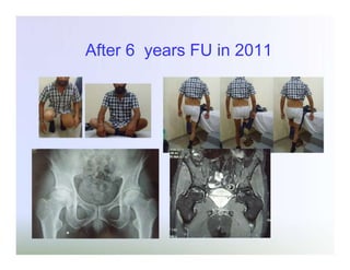 After 6 years FU in 2011

 