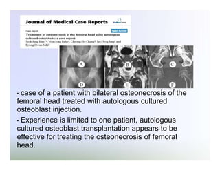 case of a patient with bilateral osteonecrosis of the
femoral head treated with autologous cultured
osteoblast injection.
• Experience is limited to one patient, autologous
cultured osteoblast transplantation appears to be
effective for treating the osteonecrosis of femoral
head.
•

 