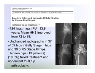•

124 hips, mean FU , 13.9
years; Mean HHS improved
from 72 to 88.

Unchanged radiographs in 37
of 59 hips initially Stage II hips
and 39 of 65 Stage III hips.
Thirteen hips (13 patients)
(10.5%) failed treatment and
underwent total hip
arthroplasty.
•

 