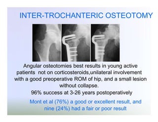 INTER-TROCHANTERIC OSTEOTOMY

Angular osteotomies best results in young active
patients not on corticosteroids,unilateral involvement
with a good preoperative ROM of hip, and a small lesion
without collapse.
96% success at 3-26 years postoperatively
Mont et al (76%) a good or excellent result, and
nine (24%) had a fair or poor result

 