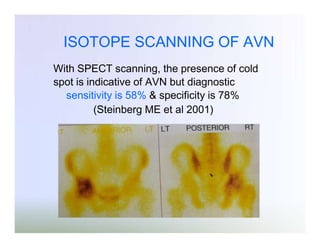 ISOTOPE SCANNING OF AVN
With SPECT scanning, the presence of cold
spot is indicative of AVN but diagnostic
sensitivity is 58% & specificity is 78%
(Steinberg ME et al 2001)

 