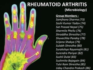RHEUMATOID ARTHRITIS (Microbiology) Group Members : Samjhana Sharma (73) Sashi Kumar Yadav (74) Sat Prasad Nepal (75) Sharmila Phellu (76) Shraddha Shrestha (77) Shuvechha Pandey (78) Srijana Shakya (79) Sulabh Shrestha (80) Surakshya Rayamajhi (81) Surendra Pariyar (82) Sushil Dulal (83) Sushmita Bajagain (84) Tulsi Ram Shrestha (85) Uday Chandra Prakash (86) 