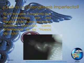 Iniciohttp://www.nlm.nih.gov/medlineplus/spanish/ency/article/001573.htm
25/04/2015
 