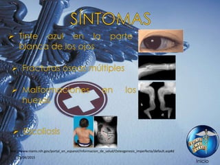 Inicio
http://www.niams.nih.gov/portal_en_espanol/Informacion_de_salud/Osteogenesis_imperfecta/default.asp#d
25/04/2015
 