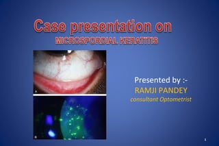 Presented by :-
RAMJI PANDEY
consultant Optometrist
1
 