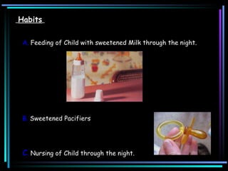 Habits   A.  Feeding of Child with sweetened Milk through the night.  B.  Sweetened Pacifiers  C .  Nursing of Child through the night.  