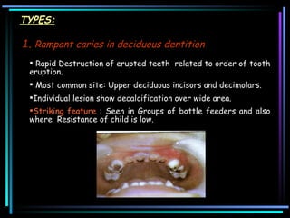 1 .  Rampant caries in deciduous dentition   TYPES: Rapid Destruction of erupted teeth  related to order of tooth eruption.  Most common site: Upper deciduous incisors and decimolars.  Individual lesion show decalcification over wide area.  Striking feature  : Seen in Groups of bottle feeders and also where  Resistance of child is low.  