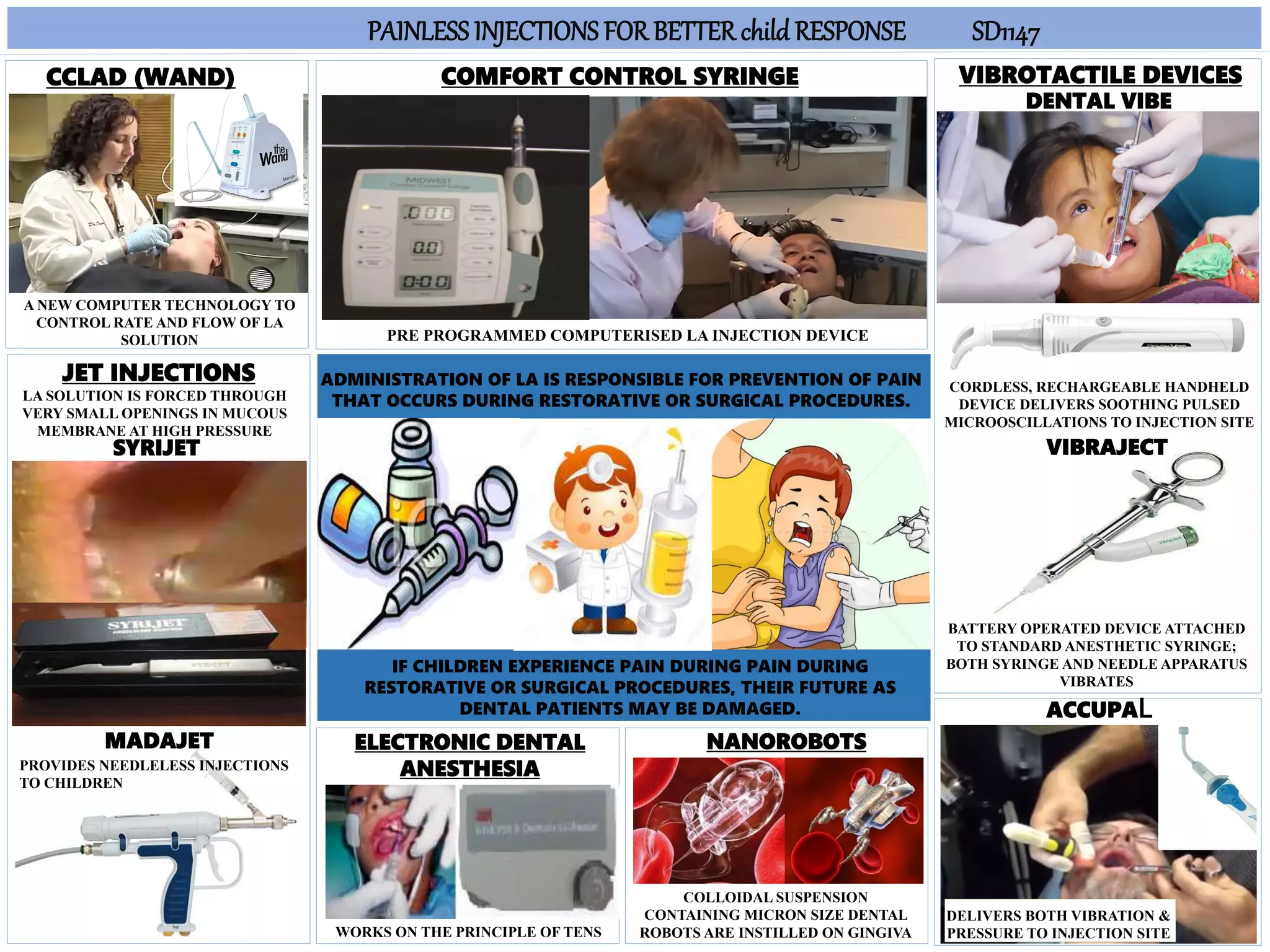 Trends in local anesthetic injection techniques PPT