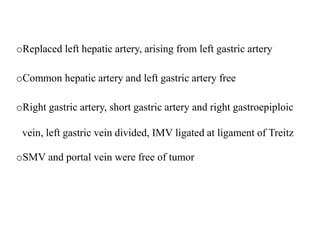 oReplaced left hepatic artery, arising from left gastric artery
oCommon hepatic artery and left gastric artery free
oRight gastric artery, short gastric artery and right gastroepiploic
vein, left gastric vein divided, IMV ligated at ligament of Treitz
oSMV and portal vein were free of tumor
 