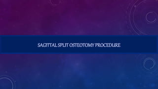 SAGITTAL SPLIT OSTEOTOMY PROCEDURE
 