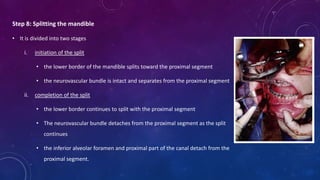 Step 8: Splitting the mandible
• It is divided into two stages
i. initiation of the split
• the lower border of the mandible splits toward the proximal segment
• the neurovascular bundle is intact and separates from the proximal segment
ii. completion of the split
• the lower border continues to split with the proximal segment
• The neurovascular bundle detaches from the proximal segment as the split
continues
• the inferior alveolar foramen and proximal part of the canal detach from the
proximal segment.
 