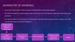 ASYMMETRY OF MANDIBLE
• Corrections include rotation, bodily movement and lateralization of the dentate segment.
• The side that receives the rotated segment, bony contact may occur at the anterior aspect potentially leaving a gap
posteriorly.
• The side from which the distal segment is pivoted away, is left with anterior gap and contact is present only at the
most posterior aspect of the proximal segment.
lateral
displacement of
the condyle
Relocation of
condyle
shift in occlusion
Mandible rotates
towards the
original side.
Relapse
Fixation of two
segments &
closure of
anterior gap
 