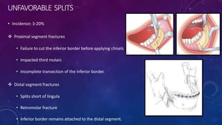 UNFAVORABLE SPLITS
• Incidence: 3-20%
 Proximal segment fractures
• Failure to cut the inferior border before applying chisels
• Impacted third molars
• Incomplete transection of the inferior border.
 Distal segment fractures
• Splits short of lingula
• Retromolar fracture
• Inferior border remains attached to the distal segment.
 