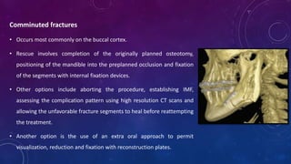 Comminuted fractures
• Occurs most commonly on the buccal cortex.
• Rescue involves completion of the originally planned osteotomy,
positioning of the mandible into the preplanned occlusion and fixation
of the segments with internal fixation devices.
• Other options include aborting the procedure, establishing IMF,
assessing the complication pattern using high resolution CT scans and
allowing the unfavorable fracture segments to heal before reattempting
the treatment.
• Another option is the use of an extra oral approach to permit
visualization, reduction and fixation with reconstruction plates.
 