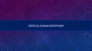 VERTICAL RAMUS OSTEOTOMY
 