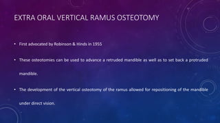 • First advocated by Robinson & Hinds in 1955
• These osteotomies can be used to advance a retruded mandible as well as to set back a protruded
mandible.
• The development of the vertical osteotomy of the ramus allowed for repositioning of the mandible
under direct vision.
EXTRA ORAL VERTICAL RAMUS OSTEOTOMY
 