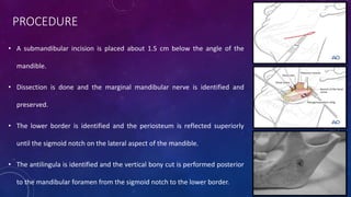 PROCEDURE
• A submandibular incision is placed about 1.5 cm below the angle of the
mandible.
• Dissection is done and the marginal mandibular nerve is identified and
preserved.
• The lower border is identified and the periosteum is reflected superiorly
until the sigmoid notch on the lateral aspect of the mandible.
• The antilingula is identified and the vertical bony cut is performed posterior
to the mandibular foramen from the sigmoid notch to the lower border.
 