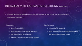 INTRAORAL VERTICAL RAMUS OSTEOTOMY (MOOSE 1964)
• It is used when large setback of the mandible is required and for the correction of severe
mandibular asymmetry
Advantages
o Less IAN morbidity
o Less flaring on the proximal segments
o No necessity for rigid fixation
o Existing TMJ dysfunction can be treated.
Disadvantages
o Post op IMF is required
o Strict protocol for active physiotherapy for
two weeks after release of IMF
 