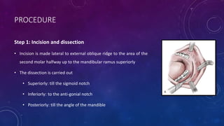 PROCEDURE
Step 1: Incision and dissection
• Incision is made lateral to external oblique ridge to the area of the
second molar halfway up to the mandibular ramus superiorly
• The dissection is carried out
• Superiorly: till the sigmoid notch
• Inferiorly: to the anti-gonial notch
• Posteriorly: till the angle of the mandible
 