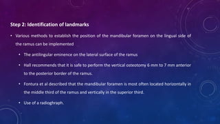 Step 2: Identification of landmarks
• Various methods to establish the position of the mandibular foramen on the lingual side of
the ramus can be implemented
• The antilingular eminence on the lateral surface of the ramus
• Hall recommends that it is safe to perform the vertical osteotomy 6 mm to 7 mm anterior
to the posterior border of the ramus.
• Fontura et al described that the mandibular foramen is most often located horizontally in
the middle third of the ramus and vertically in the superior third.
• Use of a radioghraph.
 
