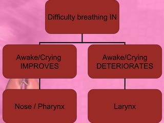 Difficulty breathing IN
Awake/Crying
IMPROVES
Awake/Crying
DETERIORATES
LarynxNose / Pharynx
 