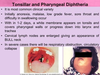 Respiratory diphtheria
• Breathing difficulty
• Husky voice
• Stridor
• Enlarged lymph nodes
• Heart rate
• Nasal discharg...