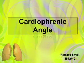Cardiophrenic
Angle
Ramzee Small
1012412
 