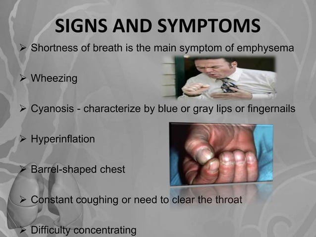 Emphysema Patient Handout – COPD (Chronic Obstructive Pulmonary Disease ...
