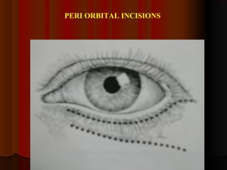PERI ORBITAL INCISIONS 
 