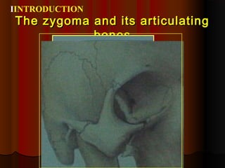 TThhee zzyyggoommaa aanndd iittss aarrttiiccuullaattiinngg 
bboonneess 
IINTRODUCTION 
 