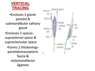 VERTICAL
TRACING
•Encloses 2 gland-
parotid &
submandibular salivary
gland
•Encloses 2 spaces-
suprasternal space &
supraclavicular space
•Forms 2 thickenings-
parotidomassaeteric
fascia &
stylomandibular
ligamen
 