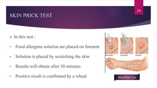 24
SKIN PRICK TEST
 In this test :
• Food allergens solution are placed on forearm
• Solution is placed by scratching the...