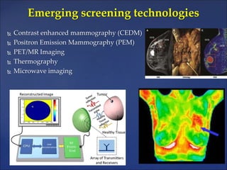Breast cancer screening | PPTX