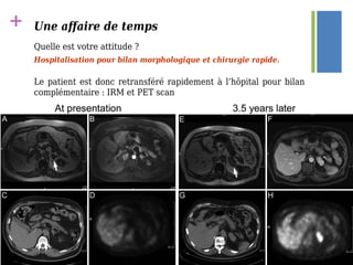 + Une affaire de temps
Quelle est votre attitude ?
Hospitalisation pour bilan morphologique et chirurgie rapide.
Le patient est donc retransféré rapidement à l’hôpital pour bilan
complémentaire : IRM et PET scan
 