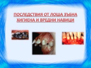 здрави зъбки