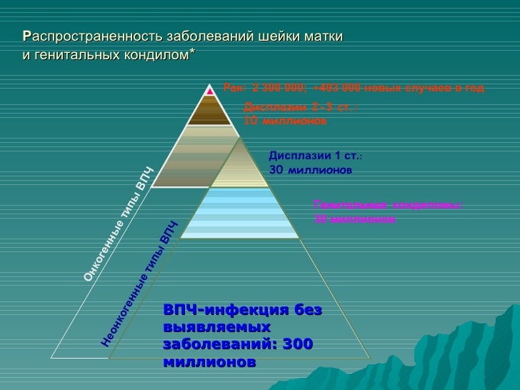 Какие есть трансмиссии
