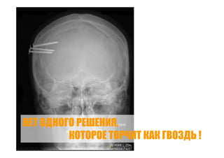 Точки роста - системный подход