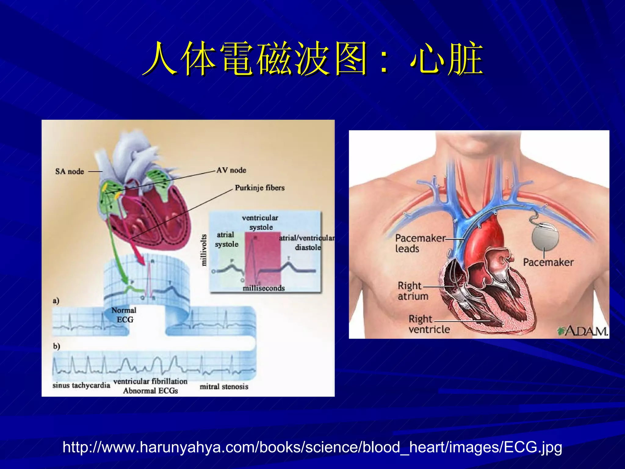 人体 電磁波 图 :  心脏 http://www.harunyahya.com/books/science/blood_heart/images/ECG.jpg 