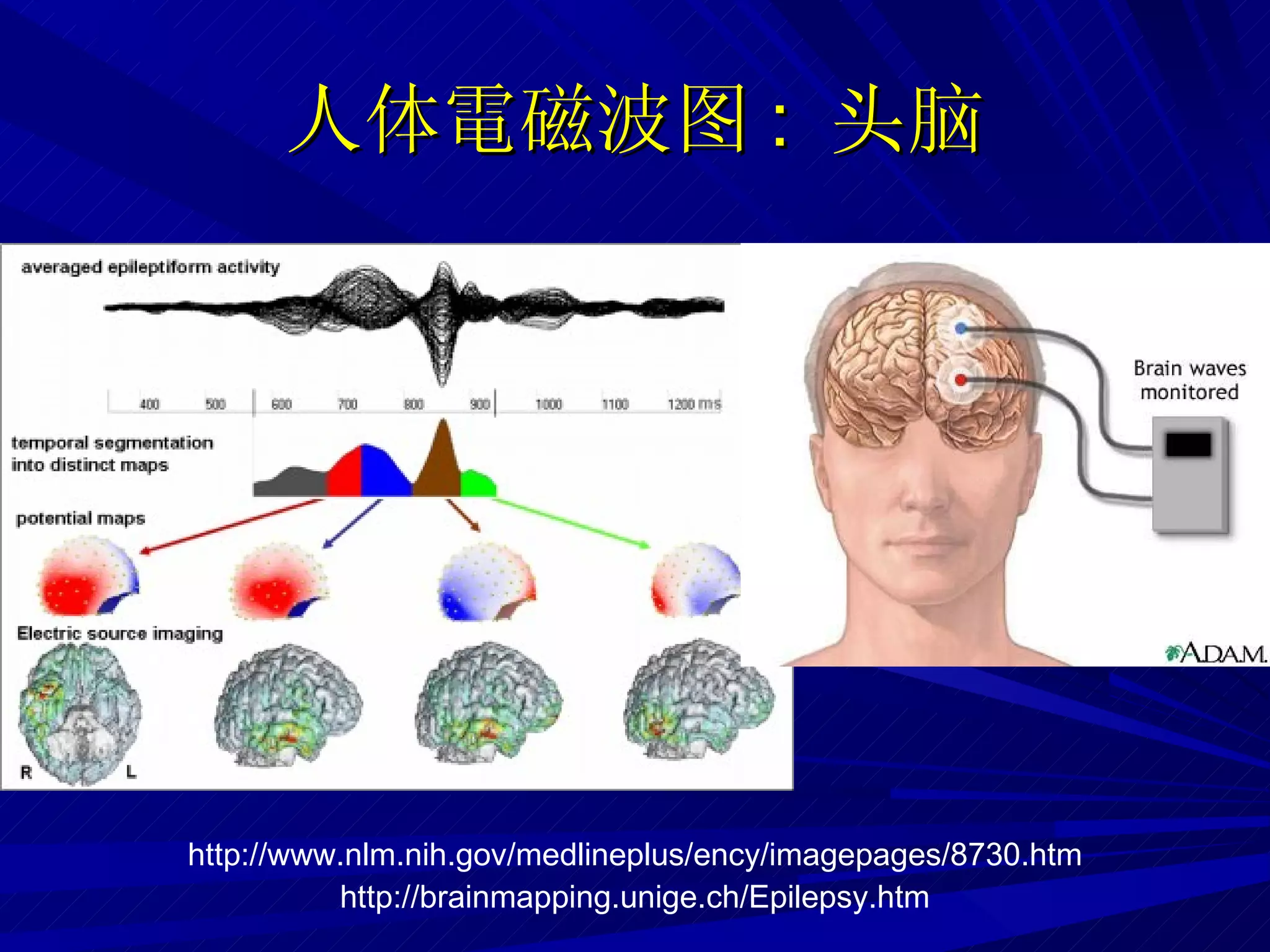 人体 電磁波 图 :  头脑 http://brainmapping.unige.ch/Epilepsy.htm http://www.nlm.nih.gov/medlineplus/ency/imagepages/8730.htm 