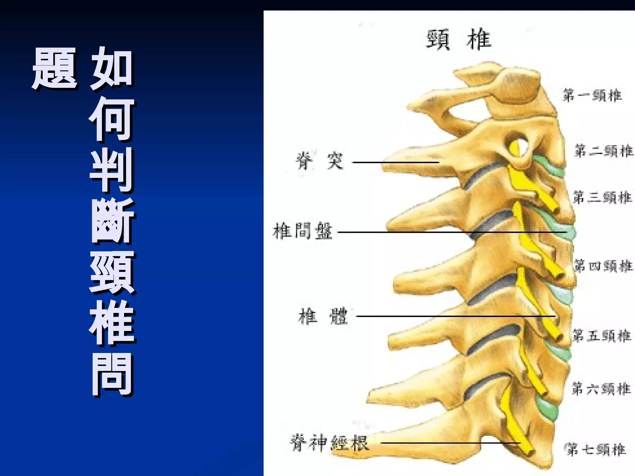 如何判斷頸椎問題 
