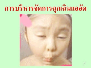 การบริหารจัดการฉุกเฉินแออัด




                          27
 
