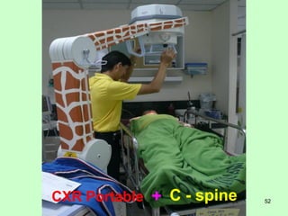 CXR Portable   + C - spine   52
 