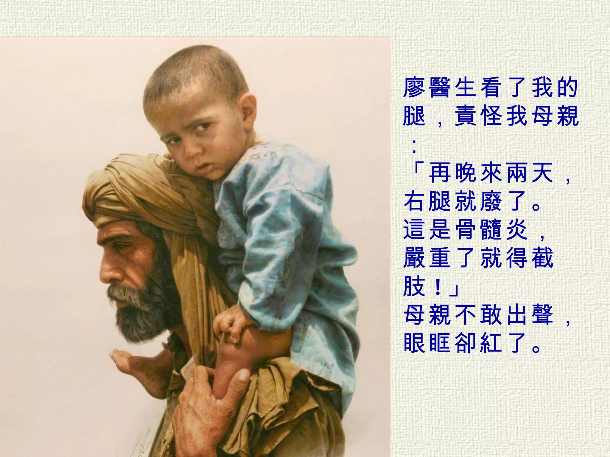 廖醫生看了我的腿，責怪我母親： 「再晚來兩天， 右腿就廢了。   這是骨髓炎， 嚴重了就得截肢 ! 」  母親不敢出聲， 眼眶卻紅了。  