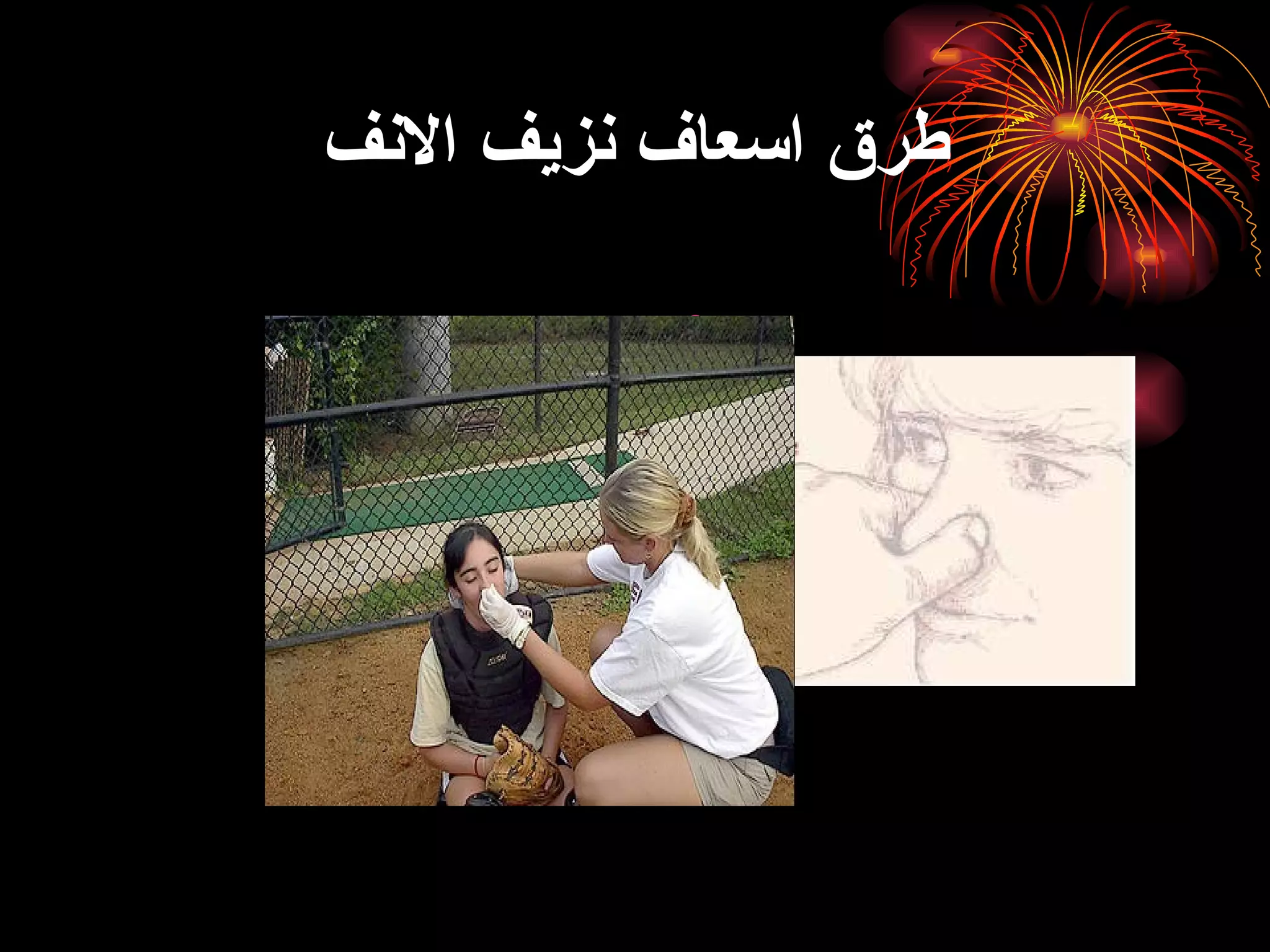 طرق اسعاف نزيف الانف 