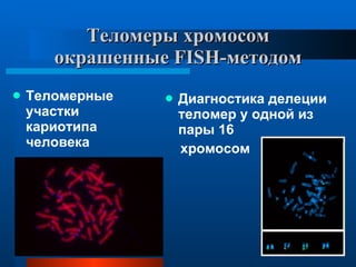 Теломеры хромосом окрашенные  FISH -методом Теломерные участки кариотипа человека  Диагностика делеции теломер у одной из пары 16 хромосом 
