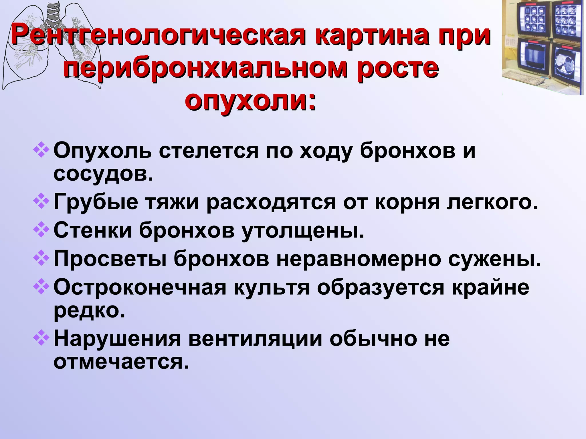 Рентгенологическая картина при перибронхиальном росте опухоли: Опухоль стелется по ходу бронхов и сосудов. Грубые тяжи расходятся от корня легкого.  Стенки бронхов утолщены. Просветы бронхов неравномерно сужены. Остроконечная культя образуется крайне редко. Нарушения вентиляции обычно не отмечается.  