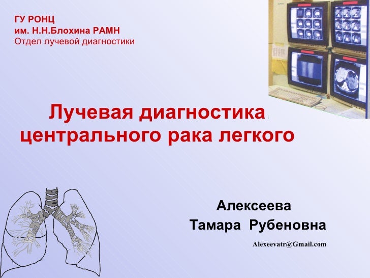 опухоли легких классификация. рентгенодиагностика легких. опухоль панкоста рентген. лучевая диагностика рака легкого. лучевая диагностика методы лучевой диагностики.